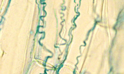 Microscope image shows blue endophyte lines in tall fescue tissue